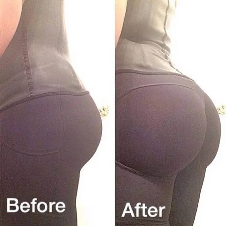 Super Up™ Butt Lifter Shapewear