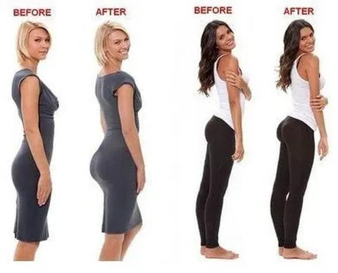 Super Up™ Butt Lifter Shapewear