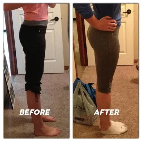 Super Up™ Butt Lifter Shapewear
